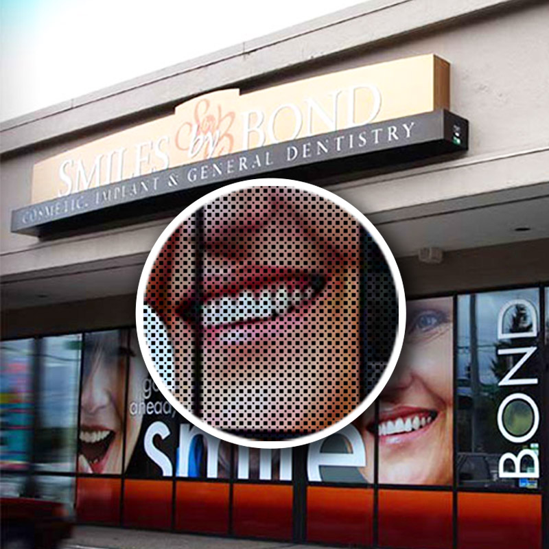 Window Graphics